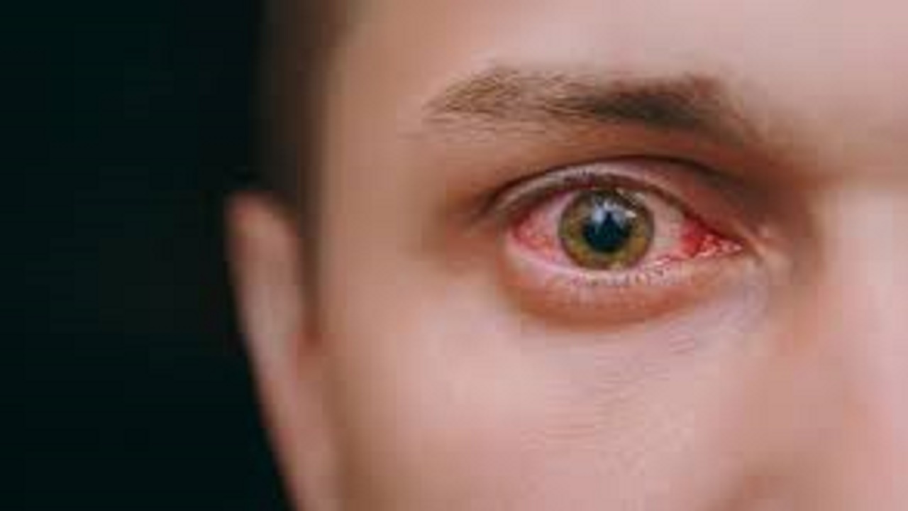 علامات خطيرة تظهر في العين كدليل على ارتفاع الكوليسترول في الدم