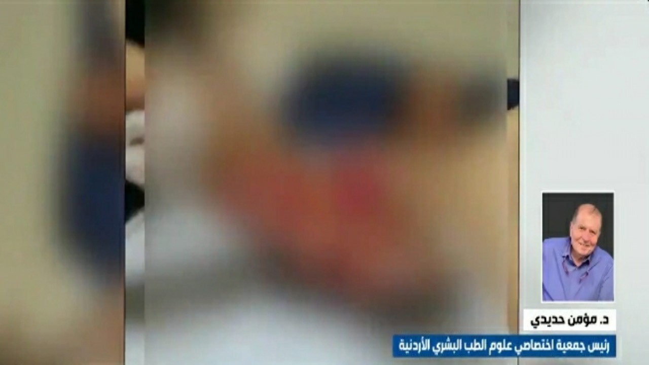 مختص أردني: من حق المواطن السعودي المتعرض للحروق أن يصطحب أفضل أطباء الطب الشرعي “فيديو”