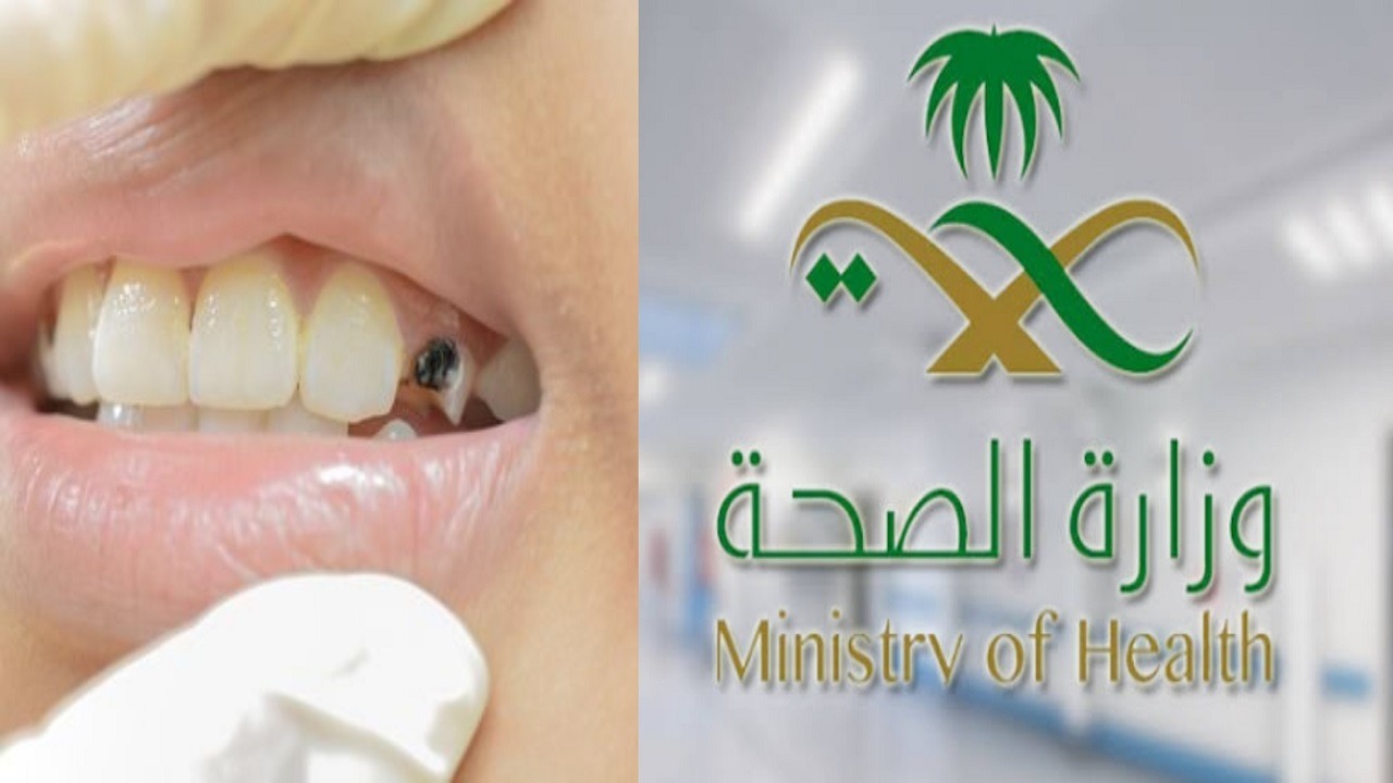 المملكة تسجل أعلى معدلات الإصابة بتسوس الأسنان