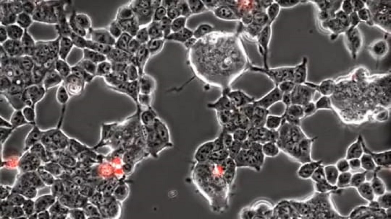 بالفيديو.. لحظة اختراق فيروس كورونا المستجد لخلايا الدماغ