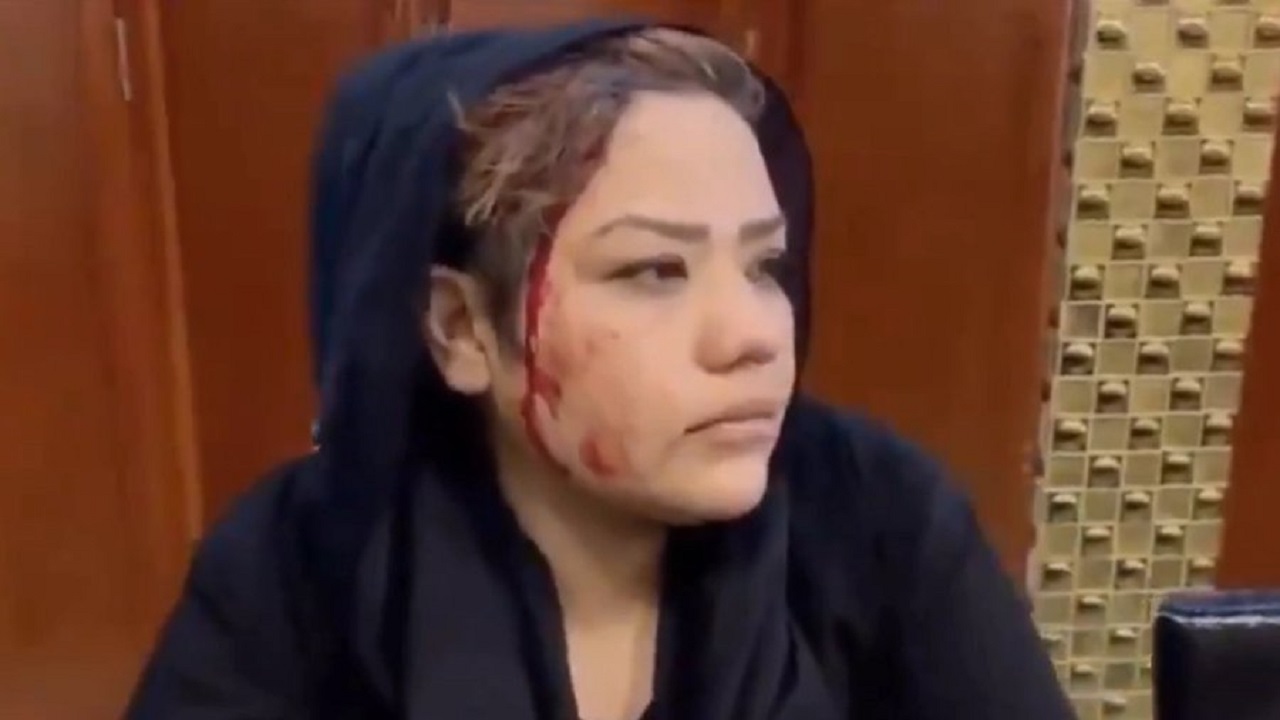 الاعتداء على ناشطة أفغانية طالبت بإنصاف المرأة