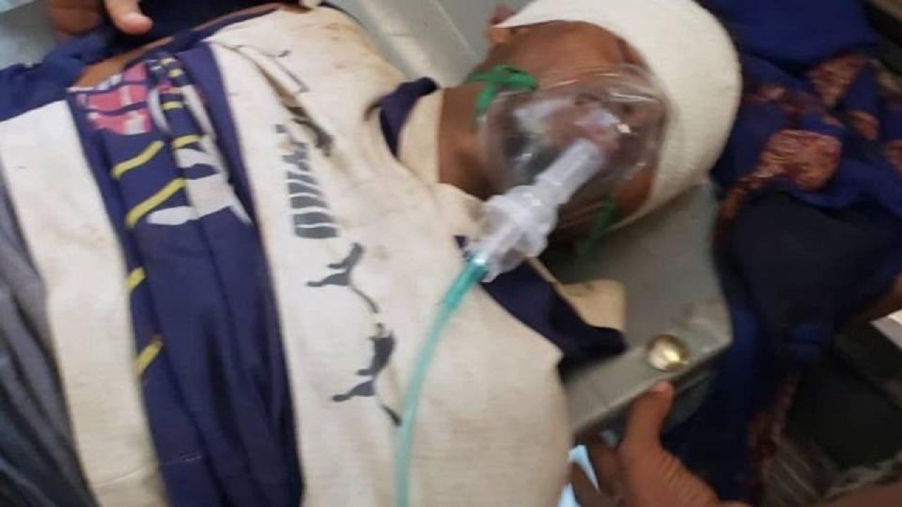 قناص حوثي يصيب شابًا يمنيًا في رأسه أثناء عمله