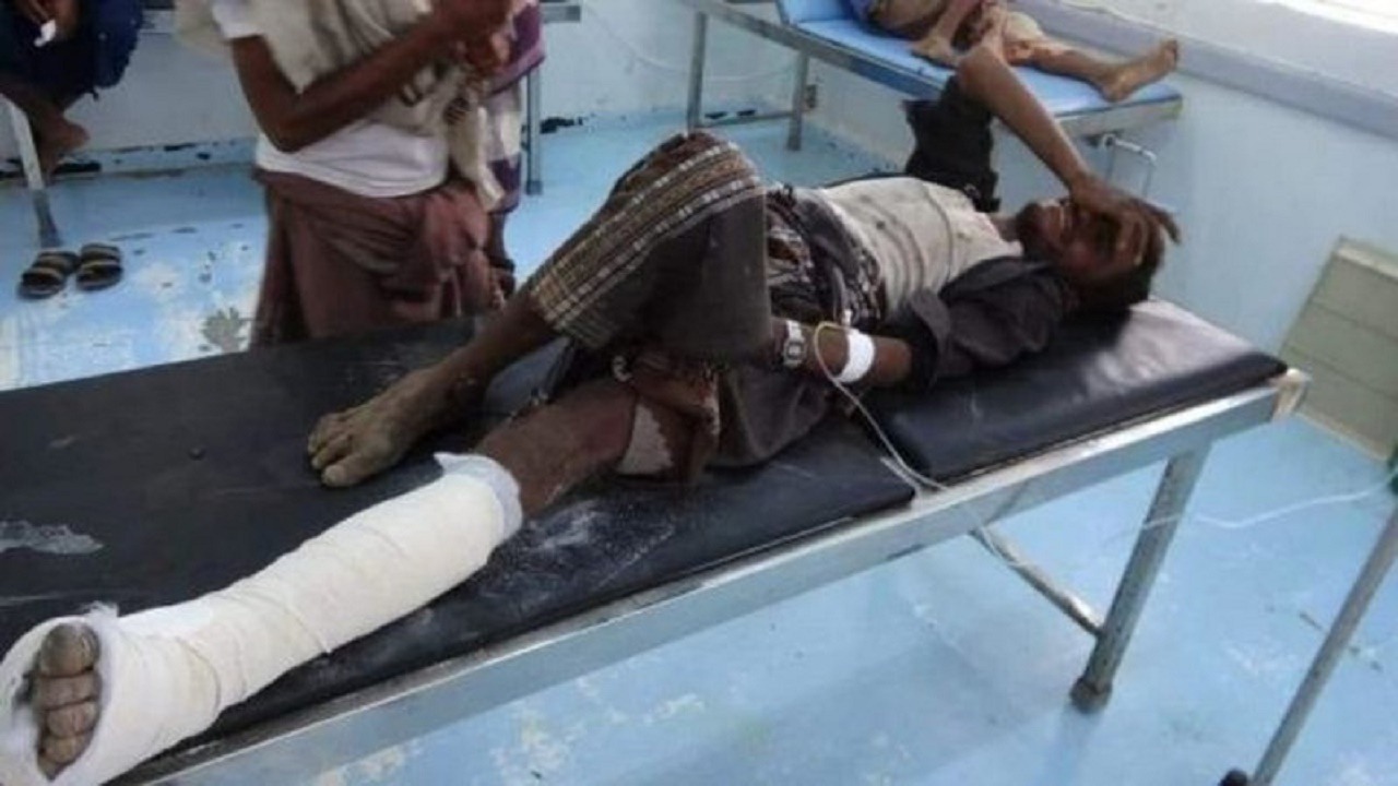 إصابة شخص في انفجار لغم حوثي في اليمن