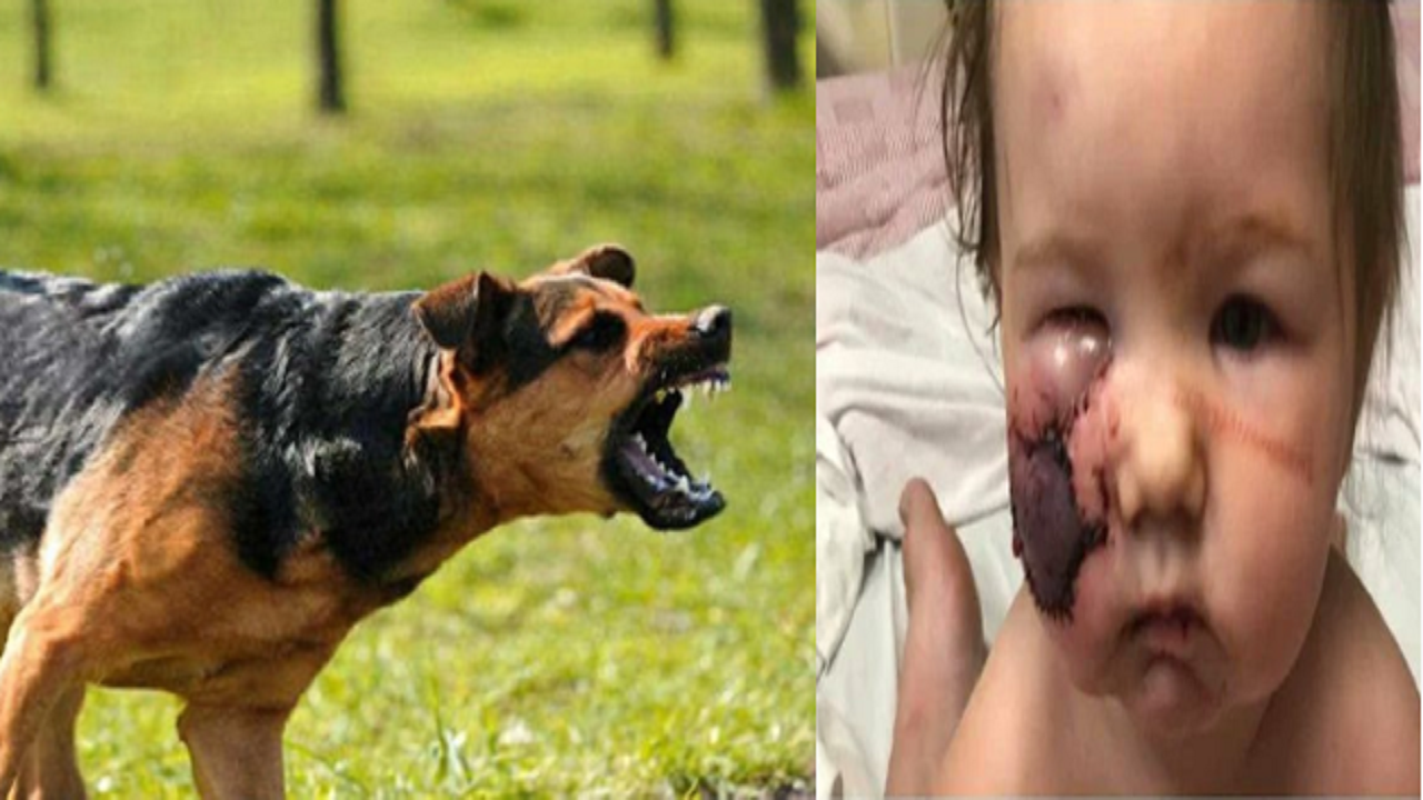 كلب شرس يلتهم خد طفلة خلال نزهة عائلية