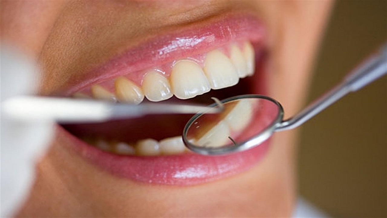 تغييرات في الفم والأسنان تحذرك من وجود خلل بجسدك