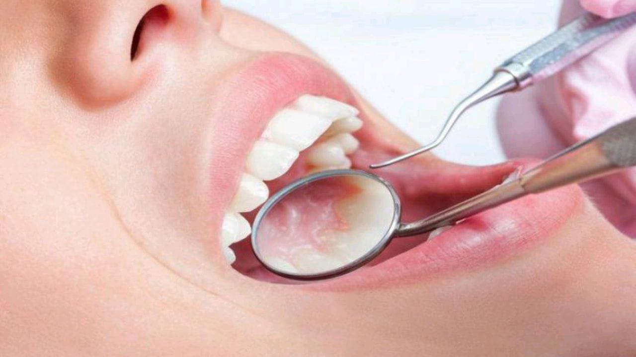 علامات في تجويف الفم تكشف عن أمراض خطيرة