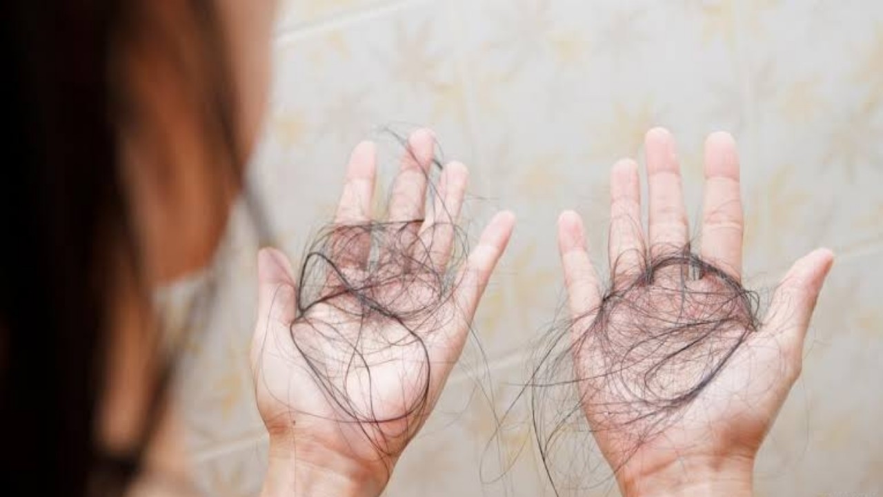 مرض غريب يؤدي إلى تساقط الشعر