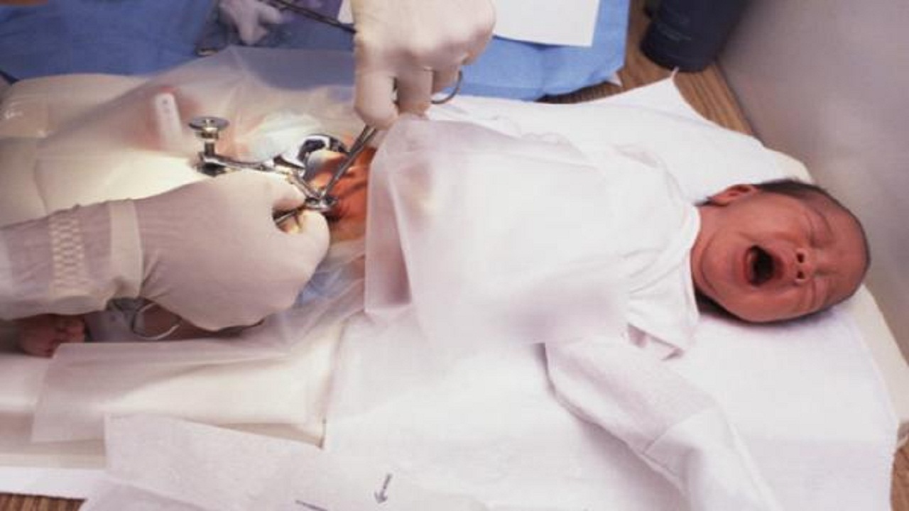 طبيب يتسبب في تشوه الجهاز التناسلي لطفل أثناء “الختان”