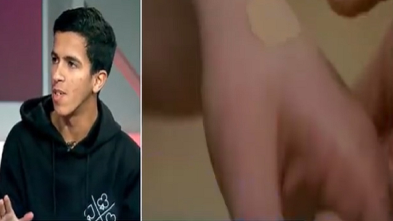 بالفيديو.. شاب يزرع شريحة إلكترونية تحت جلده بدلا من المفاتيح وبصمة الجوال