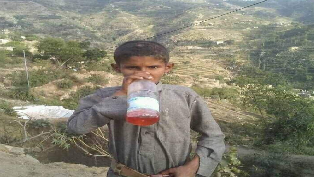 طفل يمني يمشي فقط بعد استنشاق البنزين