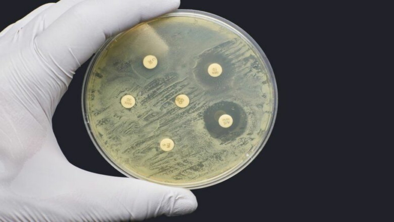 تحذير من «جائحة خفية» تجتاح العالم بعد كورونا