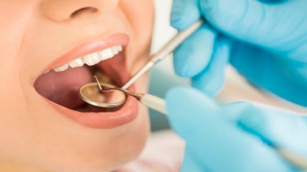 بالفيديو.. ابتكار علاج فعال و رخيص الثمن لحشوات الأسنان