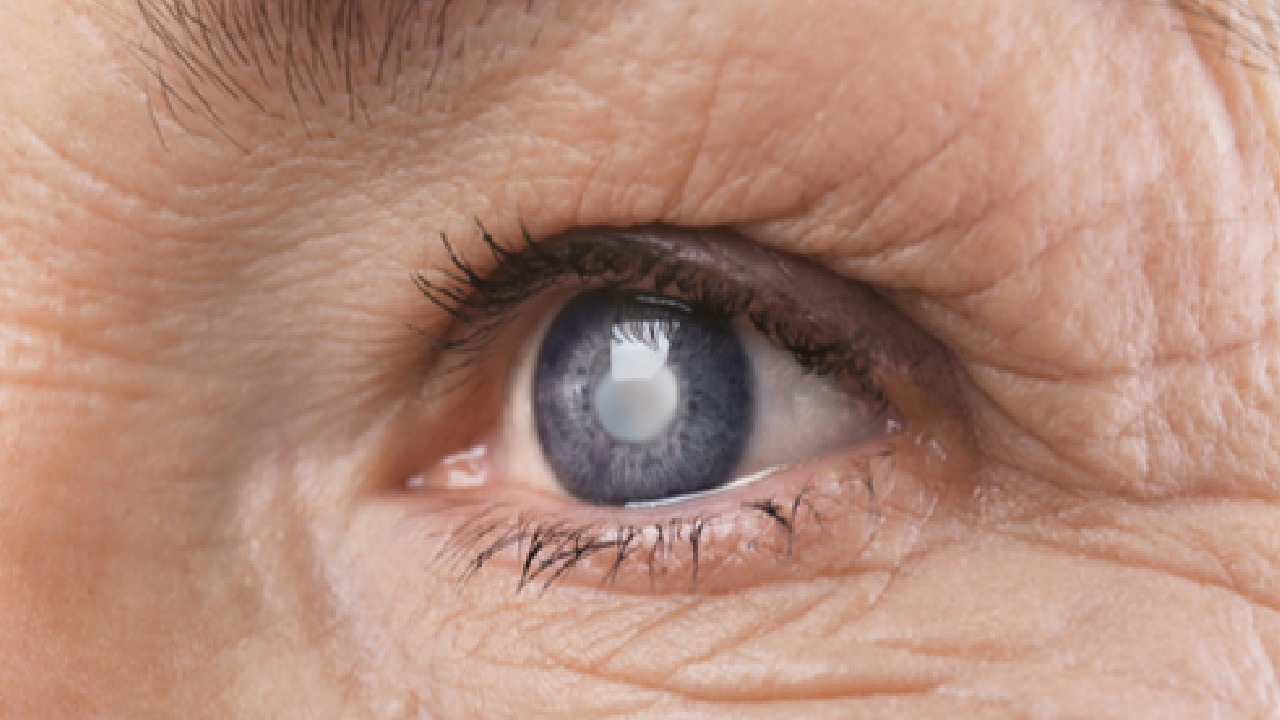 بالفيديو.. استشاري: الكورتيزون قد يؤدي لإصابة العين بالمياه البيضاء
