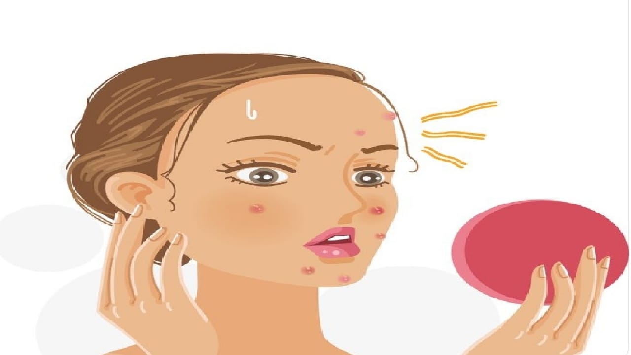 طبيبة جلدية: 4 عادات يومية تتسبب في ظهور حبوب الوجه