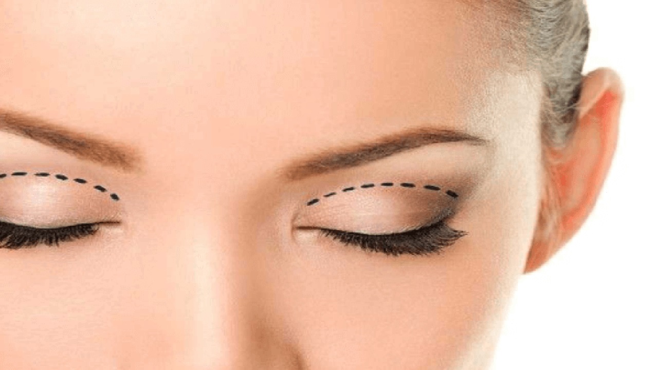 بالفيديو .. استشاري يوضح أثر عمليات الجفون على العيون