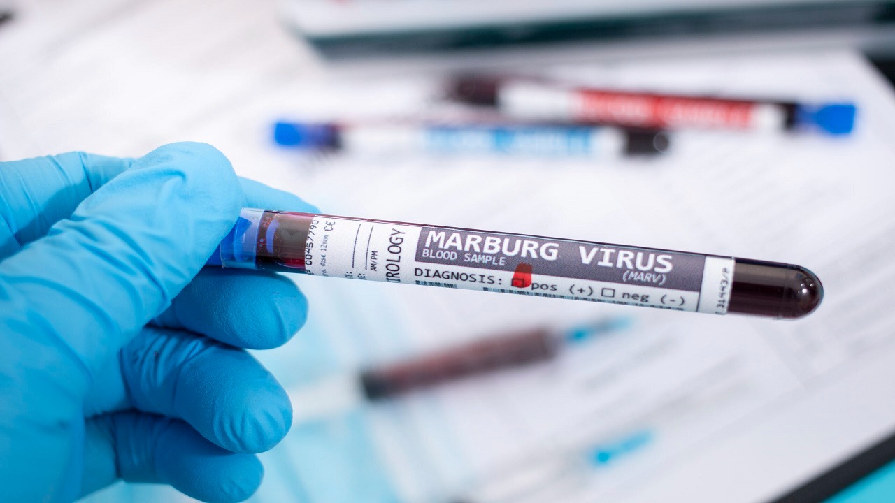 الصحة العالمية: فيروس ماربورغ يقتل المصاب خلال 3 أيام