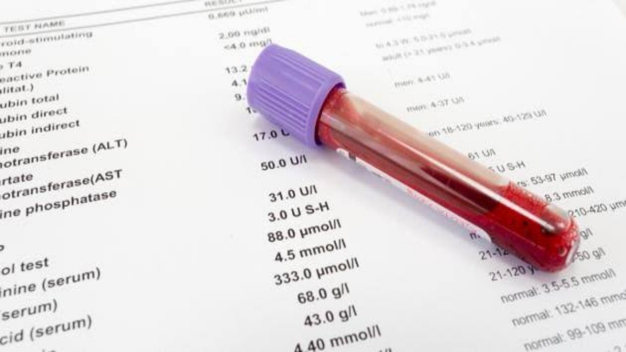 ابتكار اختبار دم جديد يقلل من وفيات مرضى السرطان