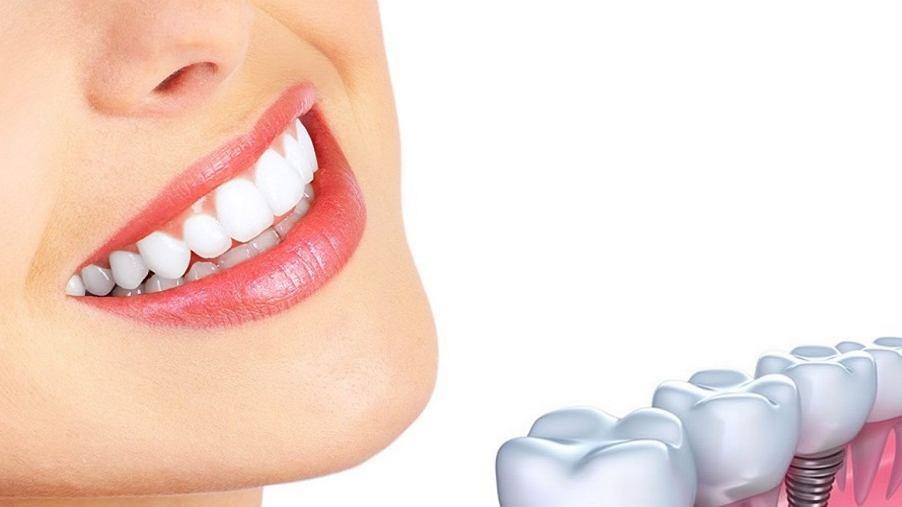 6 نصائح للحصول على ابتسامة جميلة بأسنان صحية