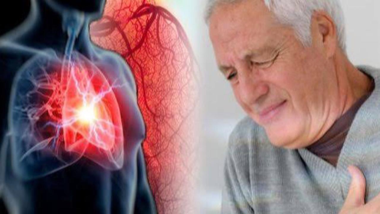 “الصحة الخليجي” يوضح سبب وأعراض السكتة القلبية وكيفية التعامل مع المُصاب بها
