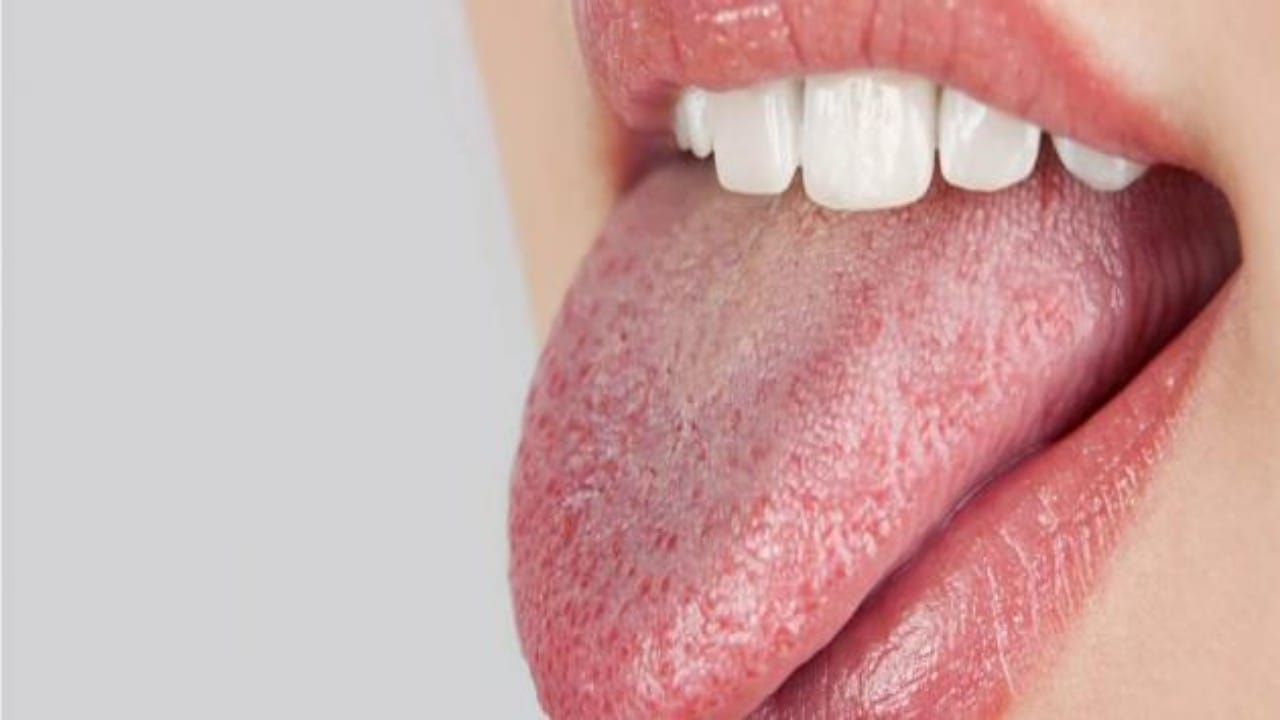 جفاف الفم يشير للإصابة بعدة أمراض