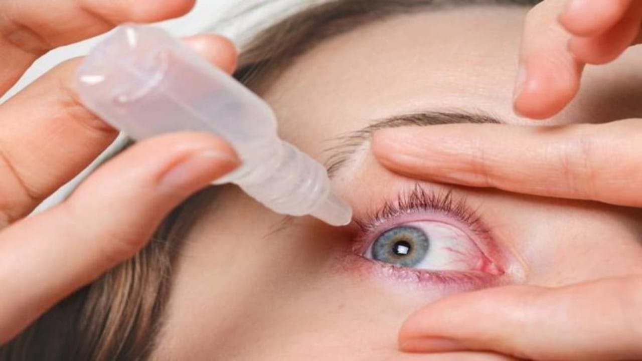 احمرار العين يشير إلى عدة مشكلات صحية