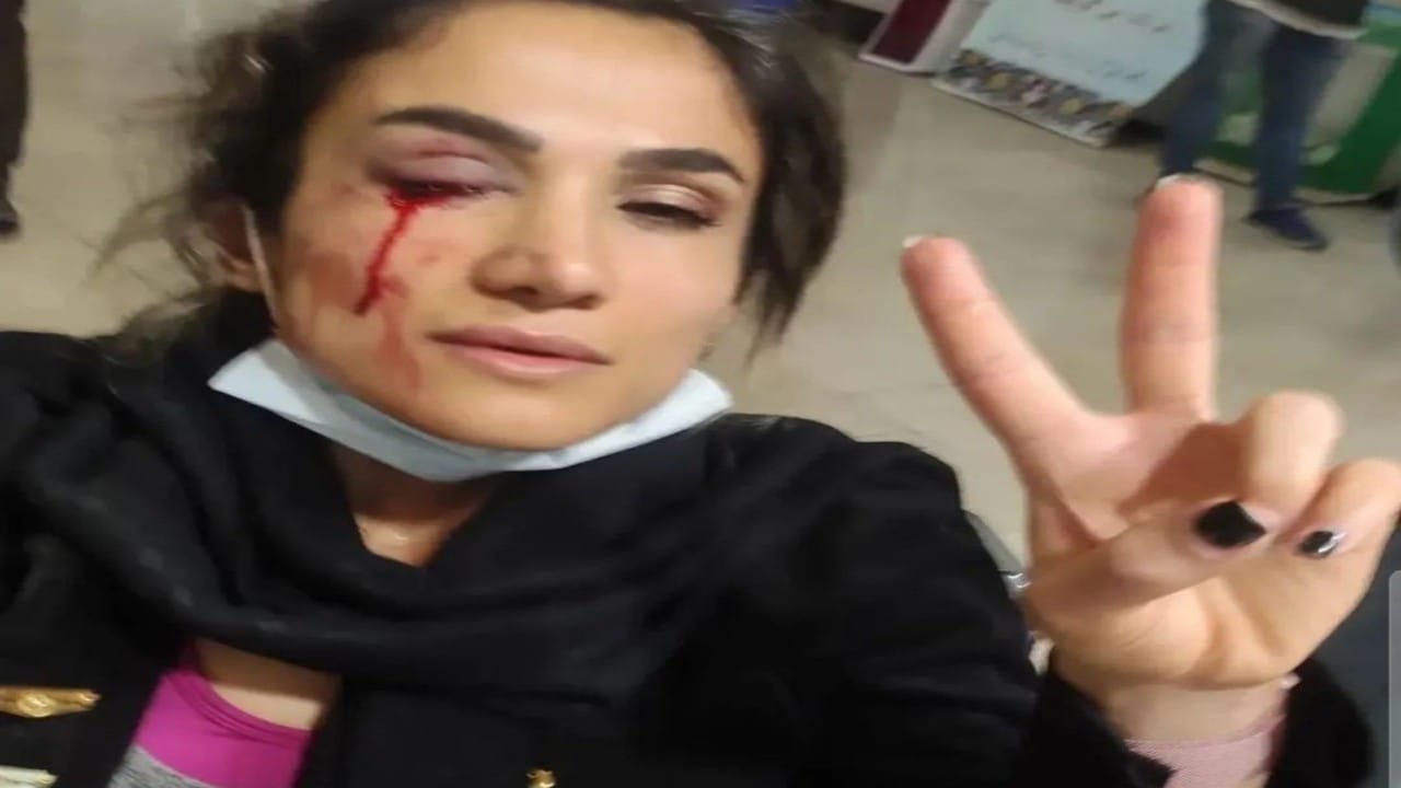 فتاة إيرانية تقاتل ضد نظام &#8220;الملالي&#8221; رغم فقدان إحدى عينيها