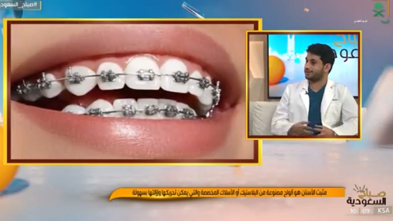 &#8220;طبيب أسنان&#8221; يوضح أنواع التقويم وأشكاله وخصائصه (فيديو)