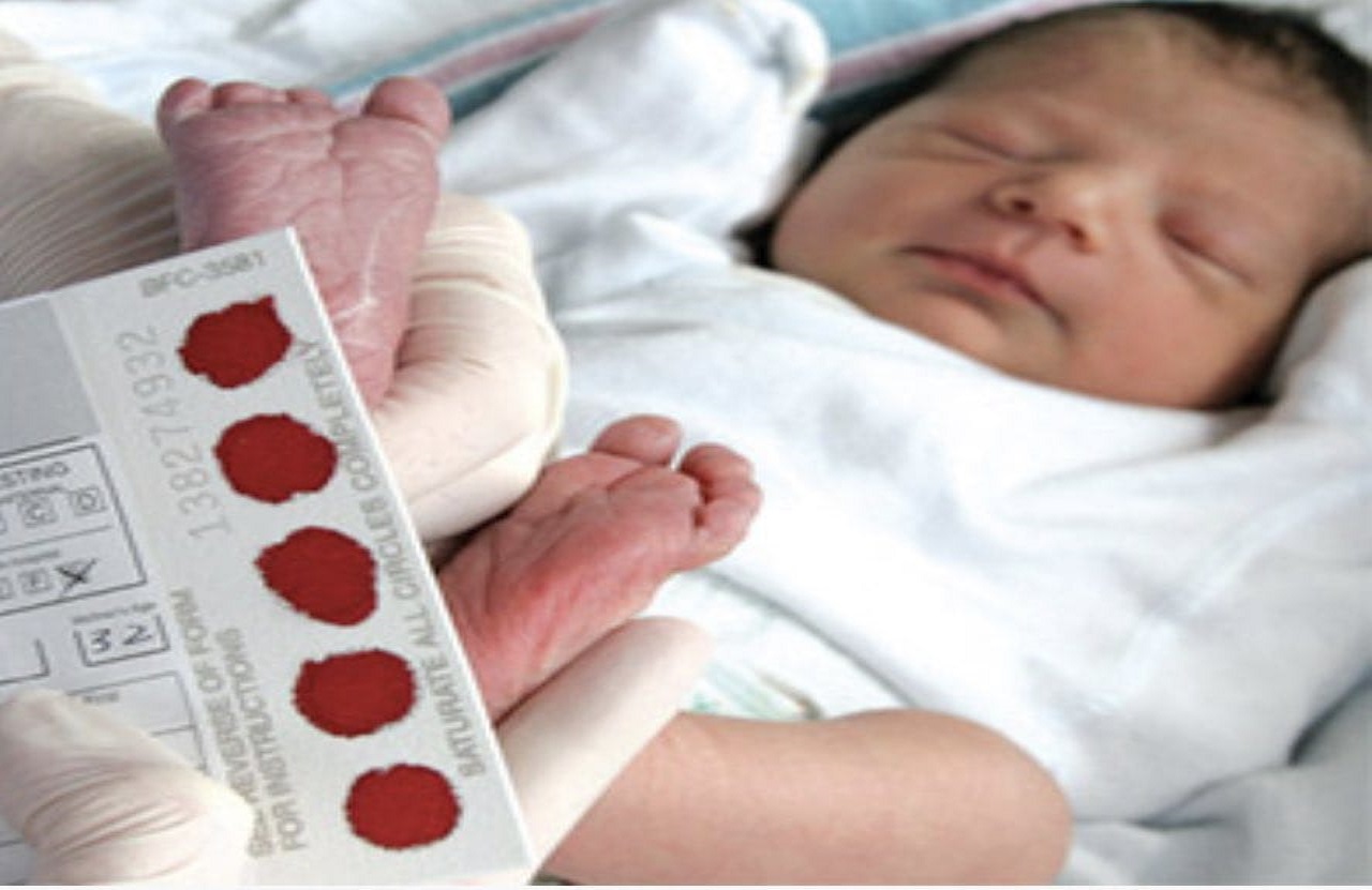 4 فحوصات طبية يجب إجرائها للطفل بعد الولادة