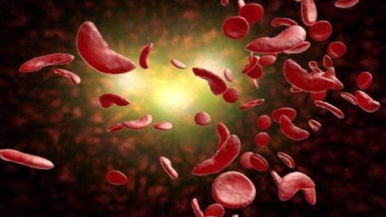 استشاري يوضح طريقة علاج ‎فقر الدم الناتج من نقص الحديد