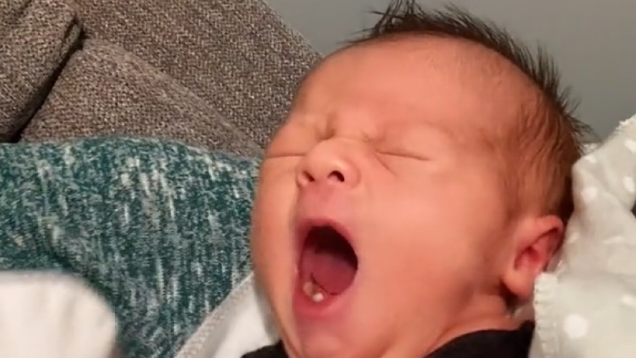 بالفيديو.. رضيع يولد بأسنان يثير ضجة واسعة على مواقع التواصل