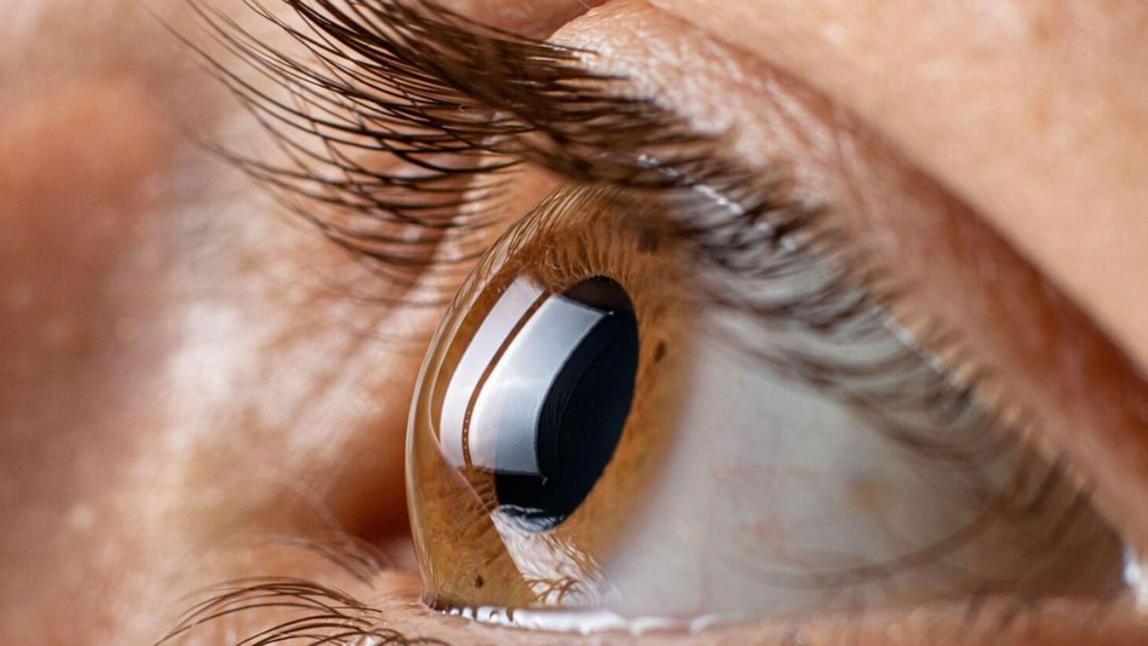 فيتامين “B3” قد يؤدي لفقدان البصر