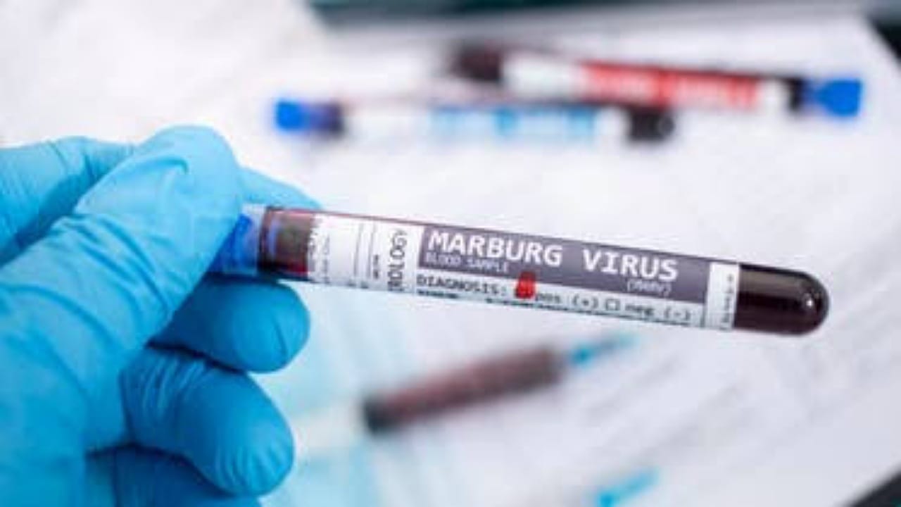 إسبانيا ترصد أول إصابة بفيروس ماربورغ الفتاك