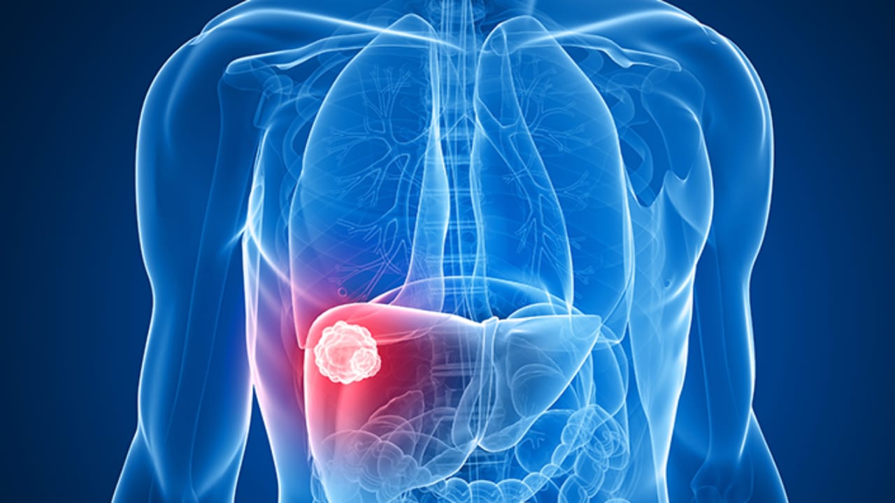 علامات في البطن تشير إلى الإصابة بسرطان الكبد