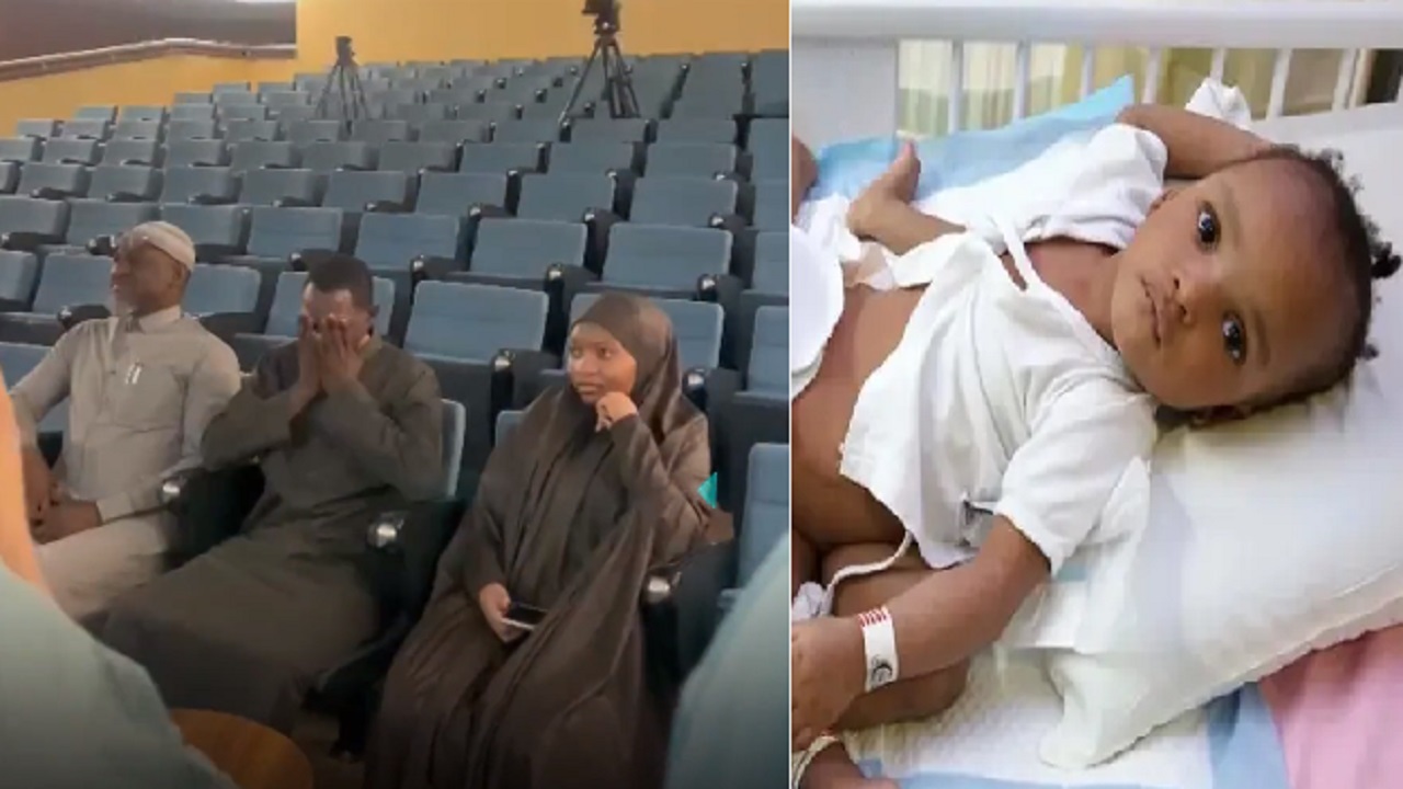 فرحة أقارب التوأم السيامي النيجيري بعد فصلهما.. فيديو