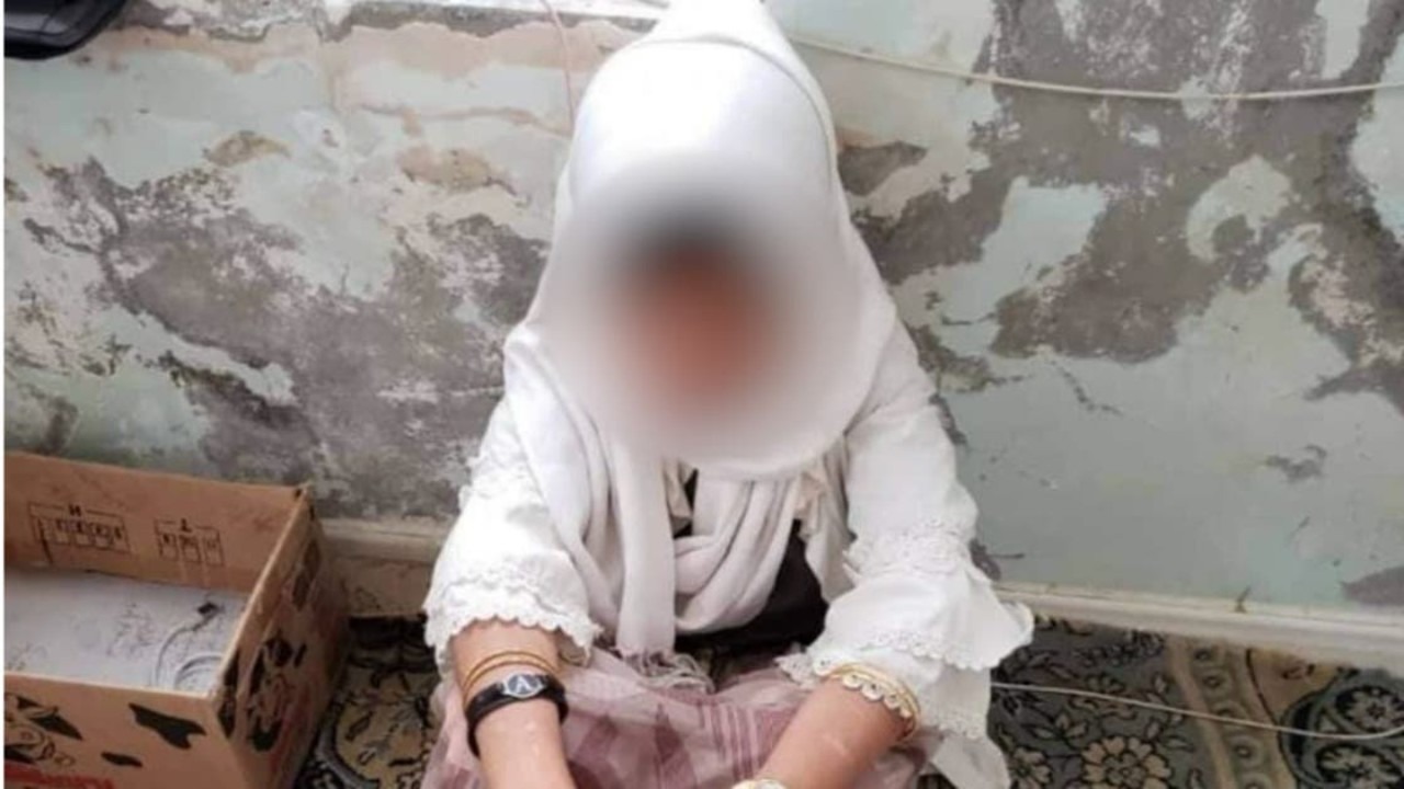جريمة هزت اليمن.. أسرة عذبت طفلتها ثم باعتها كجارية