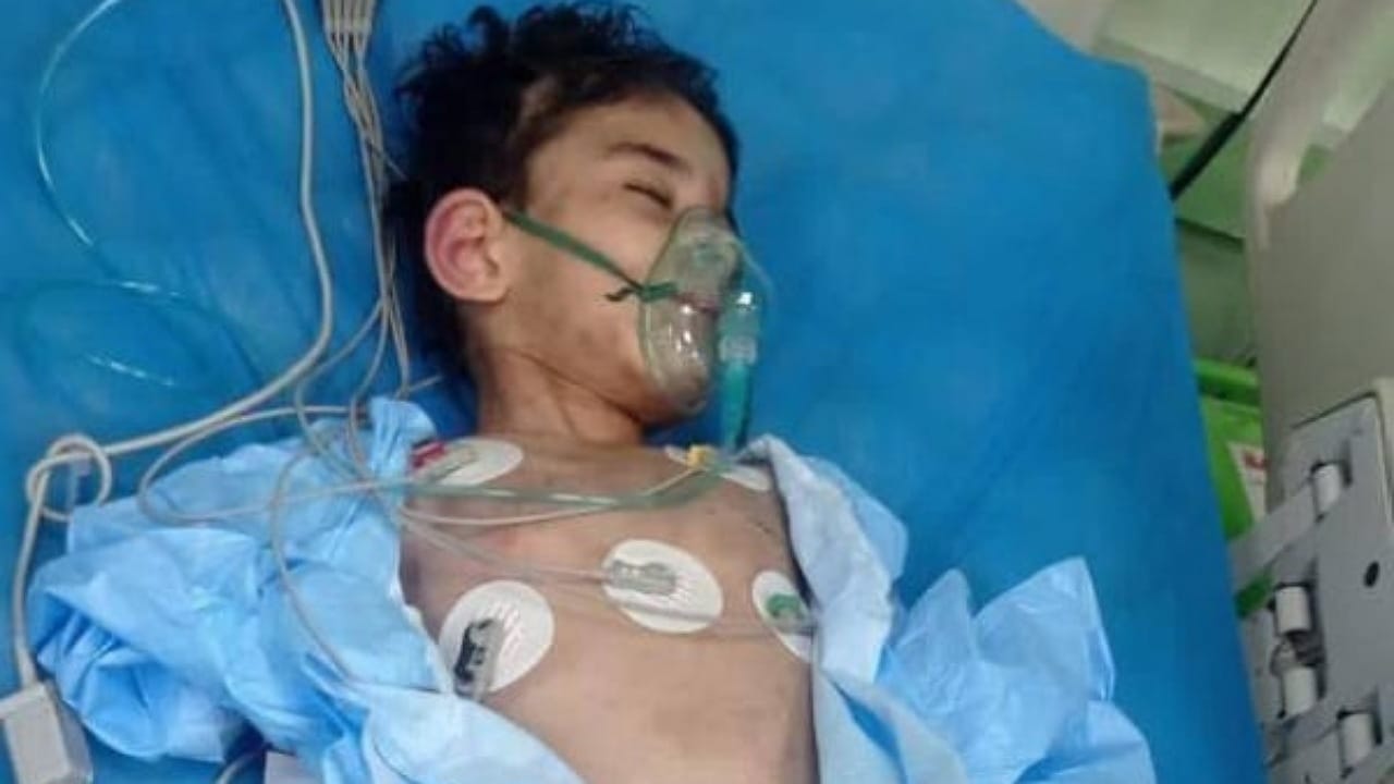 مأساة جديدة لطفل عنفته زوجة أبيه وكسرت عظامه في العراق