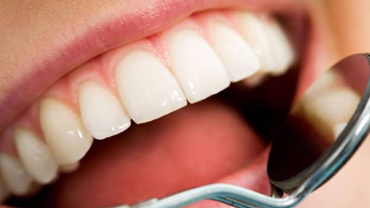 طبيب أسنان يكشف عن فواكه تسبب تآكل الأسنان