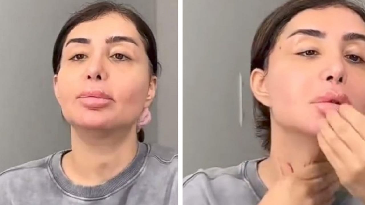 شيماء علي تثير الجدل بعد ظهورها بملامح متغيرة .. فيديو