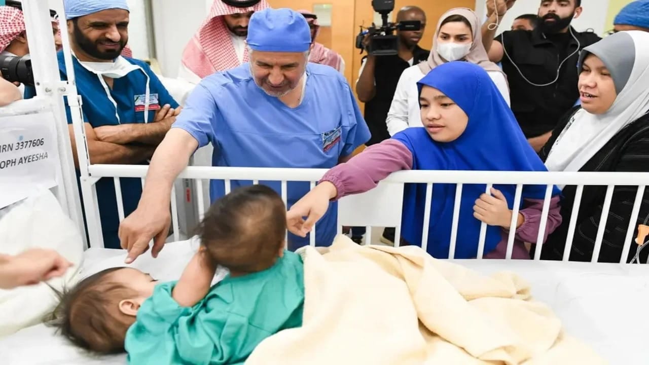 بدء عملية فصل التوأم السيامي الفلبيني بمستشفى الملك عبدالله التخصصي للأطفال بالرياض