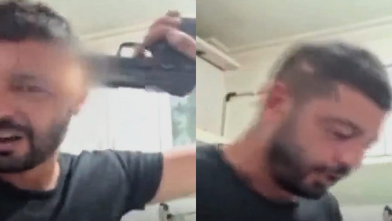تركي يُطلق النار على رأسه بالخطأ خلال بث مباشر .. فيديو
