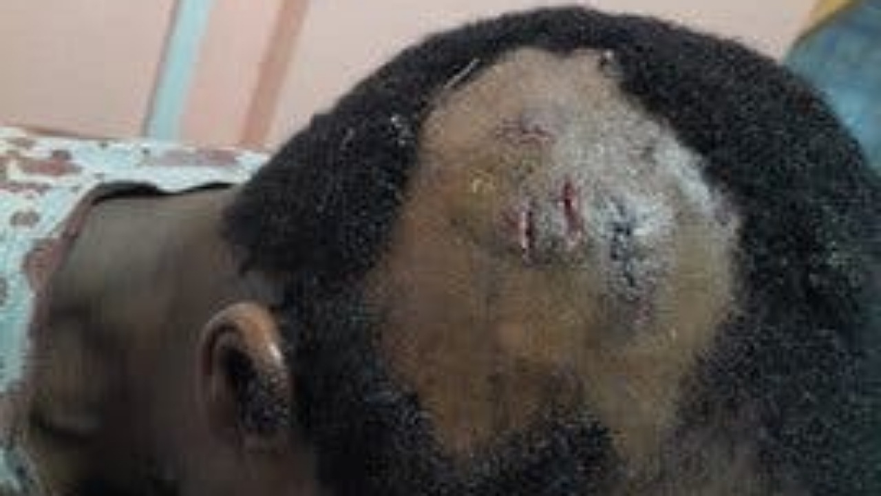 جدل حول اعتداء امرأة على زوجها بسكين.. فيديو