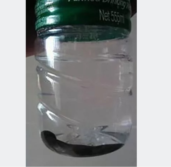 كائن حي يخرج من فم طفل يعاني من السعال.. فيديو