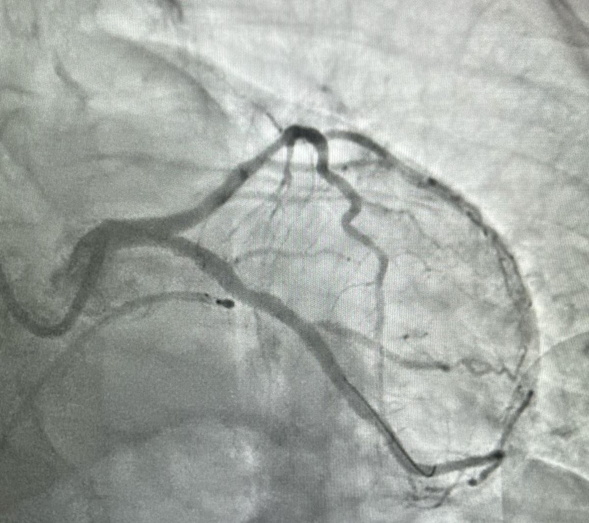 النمر: يجب أن يكون تحليل التراكمي لـ مريض السكري أقل من 7 