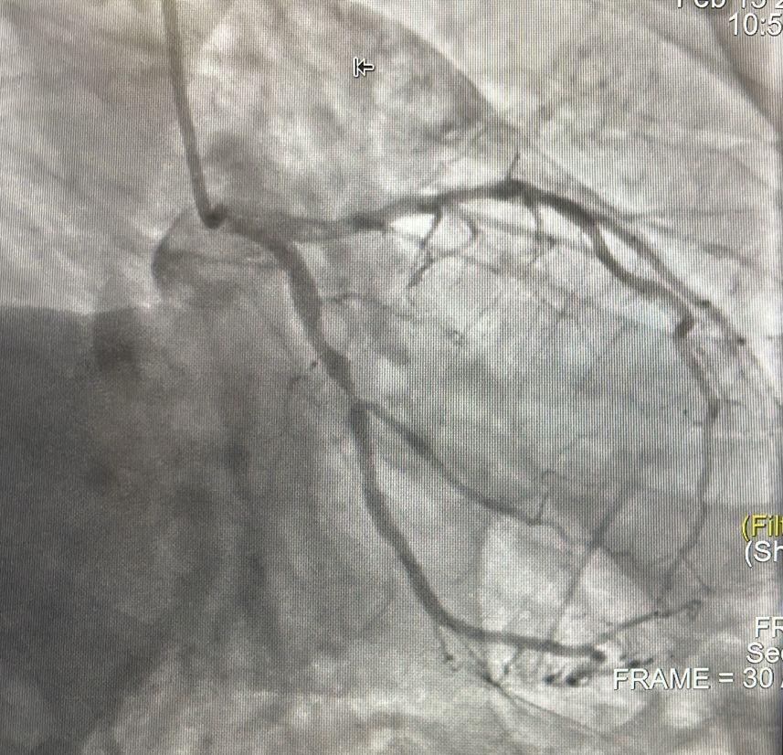 النمر: يجب أن يكون تحليل التراكمي لـ مريض السكري أقل من 7 