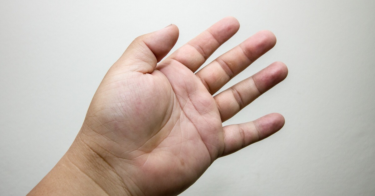 8 أسباب تؤدي لتورم الأصابع