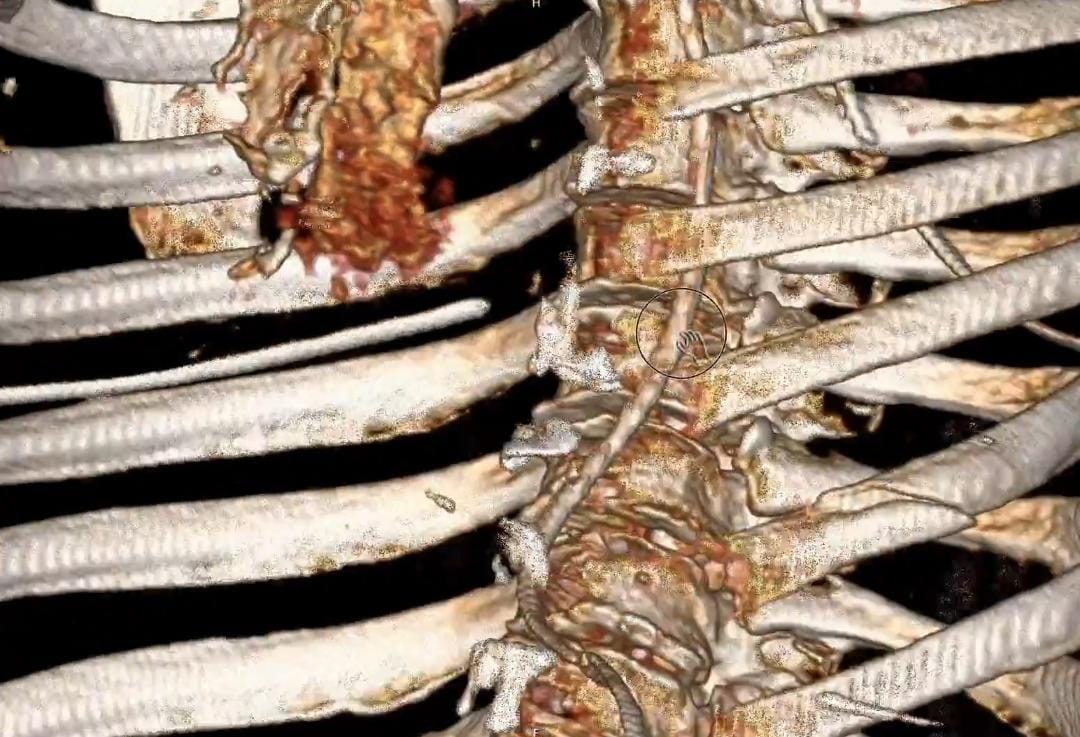 إصابات خطيرة لامرأة تكشف عواقب عدم ارتداء حزام الأمان.. صور