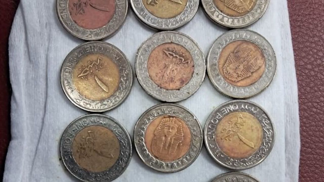 فريق طبي ينجح في استخراج 13 عملة معدنية من معدة طفل