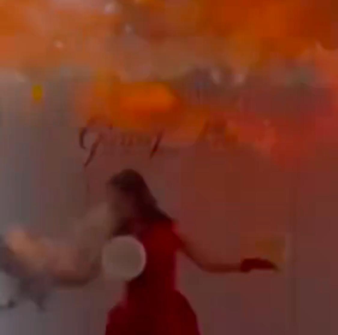 إصابة مؤثرة بحروق خطيرة بسبب انفجار بالون .. فيديو