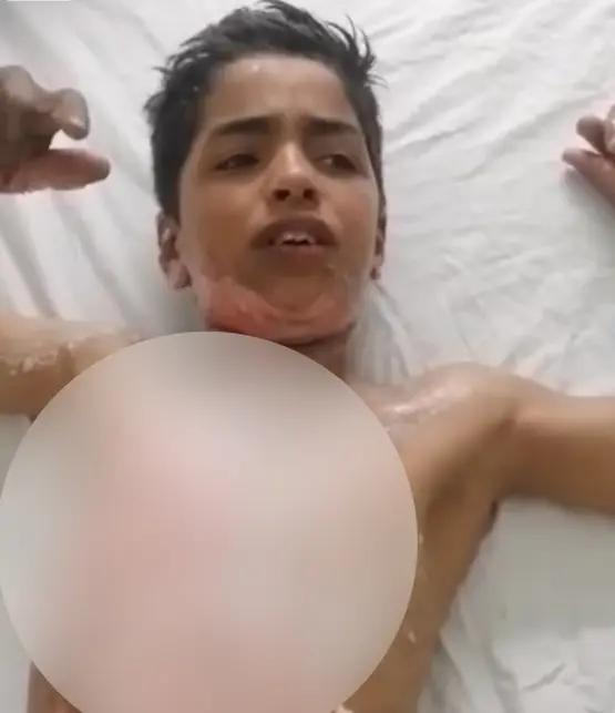  طلاب مدرسة يشعلون النار في جسد زميلهم لحرقه