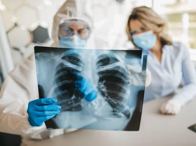  تليف الرئة أبرز آثار كورونا المستمرة